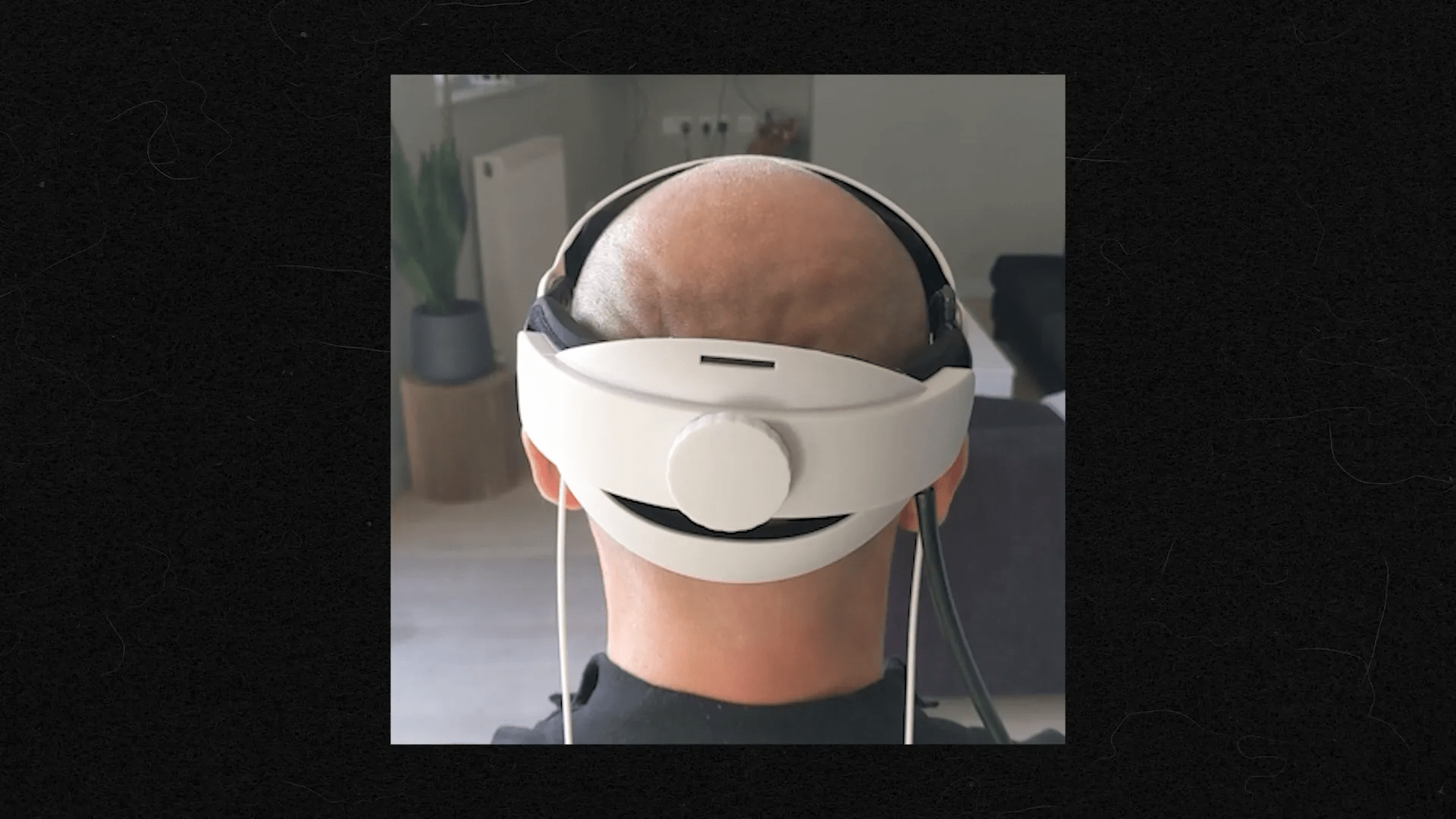 Kafa derisi masajı için kullanılan araçlar