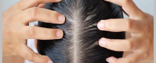 Kafa Derisi Masajı ile Saç Büyümesini Desteklemenin Yolları